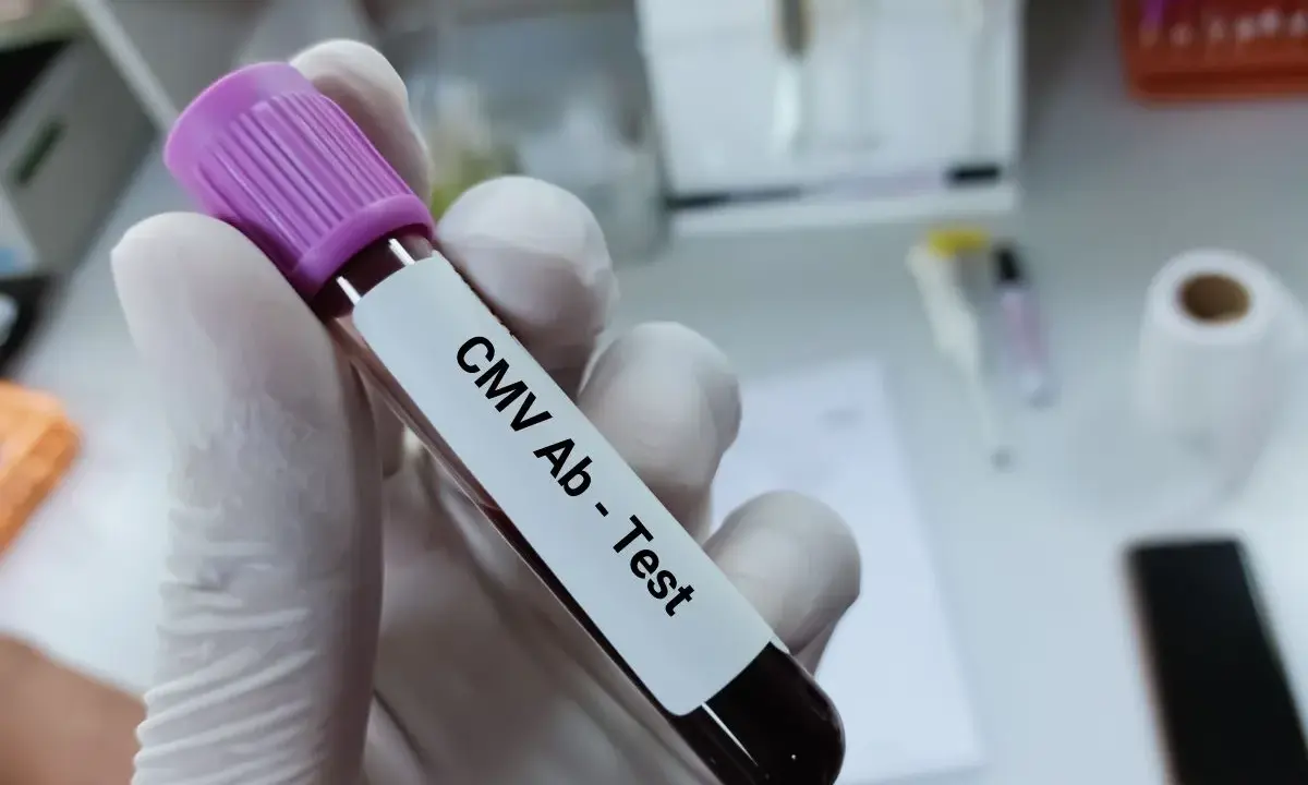Rękawiczka laboratoryjna trzyma probówkę z krwią do testu CMV Ab. To podstawa testów diagnostycznych.
