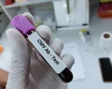 Rękawiczka laboratoryjna trzyma probówkę z krwią do testu CMV Ab. To podstawa testów diagnostycznych.