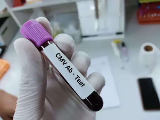 Rękawiczka laboratoryjna trzyma probówkę z krwią do testu CMV Ab. To podstawa testów diagnostycznych.